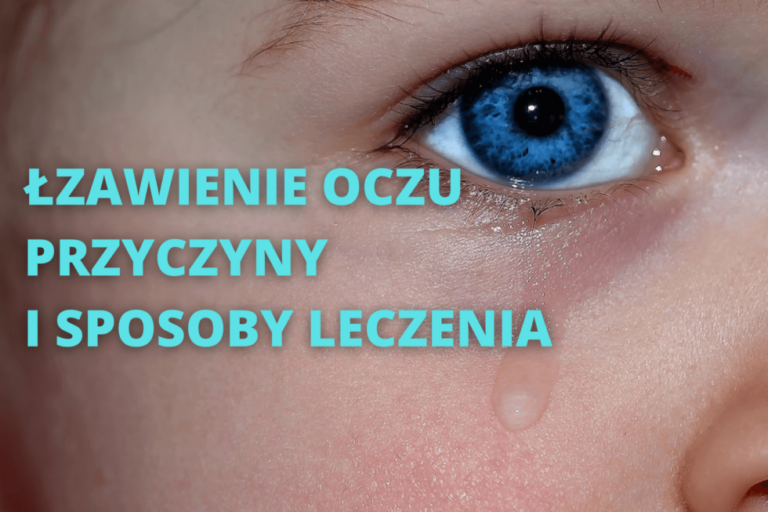Łzawienie oczu przyczyny i leczenie